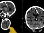 hasil-ct-scan-pada-otak-wanita-rusia-80-asal-pulau-sakhalin.jpg