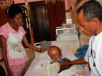 hydrocephalus_20160904_064717.jpg
