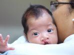 ilustrasi-anak-penderita-bibir-sumbing-bgdhygn.jpg