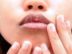 ilustrasi-bibir-kering-dan-pecah-pecah-dan-cara-mengatasinya.jpg