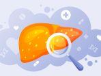 ilustrasi-fatty-liver-atau-lemak-hati-dan-ilustrasi-hati-sadgq3w4.jpg