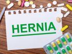 Hernia Jangan Dianggap Sepele Karena Bisa Menimbulkan Komplikasi, Berikut Pencegahannya