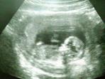 ilustrasi-orok-bayi-janin_20160421_152921.jpg