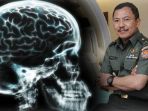 ilustrasi-otak-dan-dokter-terawan_20180403_221619.jpg