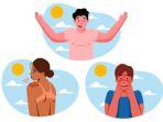 ilustrasi-sunburn.jpg