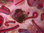 Wabah Ebola Terjadi Lagi, Epidemiolog Sarankan Indonesia Perlu Siaga Hadapi Risiko Impor dari Afrika