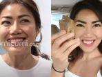 inge-anugrah-siap-move-on-kini-percantik-diri-dengan-perawatan-gigi.jpg