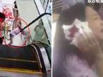 insiden-eskalator-anak-gadis-terjepit.jpg