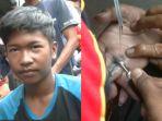 jari-laki-laki-bocah-di-bekasi-bengkak-karena-pakai-cincin-kekecilan.jpg