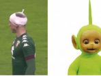 joe-hart-teletubiesssss_20170114_002602.jpg