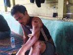 jordan-aruan-alami-luka-dan-kini-berada-di-rumahnya-masih-dalam-pemulihan.jpg