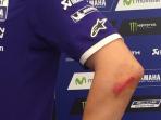 jorge-lorenzo-lecet_20160606_064947.jpg