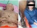 kabar-terbaru-pria-yang-alat-vitalnya-disayat-selingkuhan-di-sibolga-operasi-penyambungan-berhasil.jpg