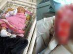 kaki-bayi-melepuh-usai-ikut-program-stunting.jpg
