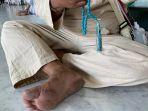 kaki-jemaah-haji-indonesia-melepuh.jpg