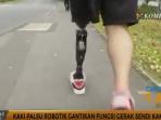 kaki-palsu-robotik-gantikan-fungsi-gerak-sendi-kaki_20161105_171008.jpg