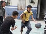 Kisah Viral Bocah Tiongkok Berkaki Satu Main Basket dengan Tongkat Kayu, Kini Pakai Kaki Palsu