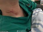 karena-mertuanya-meninggal-dua-orang-dokter-di-cina-dipukuli-secara-kejam-oleh-seorang-pria.jpg