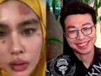 kartika-putri-dan-dokter-richard-lee-eth.jpg