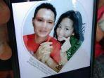 kasus-suami-bakar-istri-di-surabaya.jpg
