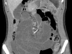 kawat-gigi-nih2_20170808_173540.jpg