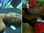 kedua-pemuda-yang-terlibat-duel-berdarah-sama-sama-masuk_20180130_221352.jpg