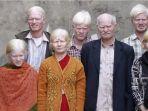 keluarga-albino-di-india.jpg