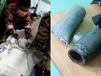 kemaluan-seorang-remaja-terjebak-di-dalam-pipa-besi.jpg