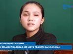 kevia-naswa-korban-selamat-tragedi-kanjuruhan-ss.jpg