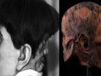 kisah-edward-mordrake-bangsawan-inggris-yang-memiliki-dua-wajah.jpg