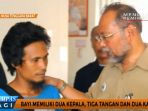 kondisi-bayi-kembar-siam-2-kepala-3-tangan-mulai-membaik_20170412_120630.jpg