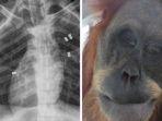 kondisi-hope-orangutan-yang-ditembak.jpg