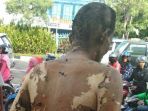 kondisi-korban-yang-dibakar-orang-tak-dikenal-di-jalan-sudirman-pekanbaru_20171125_195558.jpg