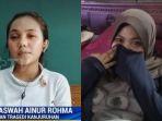 kondisi-mata-korban-tragedi-kanjuruhan.jpg