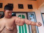 kondisi-terkini-aria-permana_1.jpg