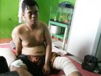 korban-begal_20180808_183659.jpg