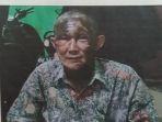 korban-m-irsyad-mengalami-luka-bakar.jpg