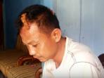 korban-pembacokan_20160229_114453.jpg