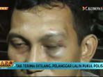 korban-pemukulan_20170607_191305.jpg