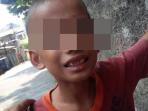 korban-pemukulan_jpeg_20150919_161226.jpg
