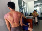 korban-penganiayaan-oknum-aparat-visum_20150216_152741.jpg