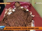 korban-penyerangan-anjing-liar_20170104_171017.jpg