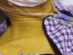 kulit-kuning111.jpg