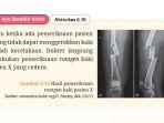 kunci-jawaban-biologi-kelas-11-halaman-189-dan-190-kurikulum-merdeka.jpg
