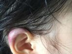 kuping-memar_20180316_195049.jpg
