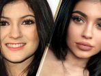 kylie-jenner-before-after_20181010_183522.jpg