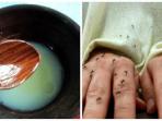 lotion-nyamuk_20160206_131149.jpg