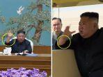 luka-di-tangan-kim-jong-un.jpg