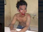 maling-motor-dihajar-warga-usai-gagal-mencuri-sepeda-motor-di-jalan-musyawarah.jpg