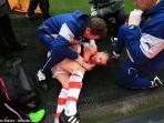 mathieu-debuchy-cedera-bahu_20150112_074658.jpg